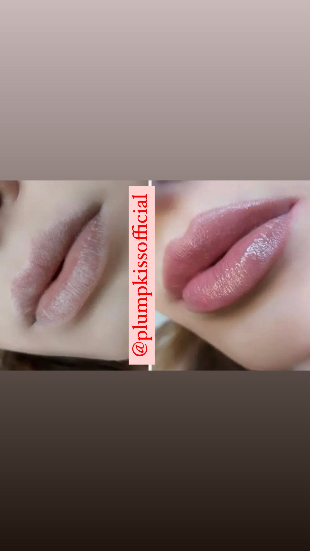 💋 NO NEEDLE LIP PLUMPER GLOSS